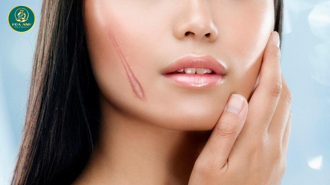 Tiêm thuốc trị sẹo lồi có ảnh hưởng gì không?