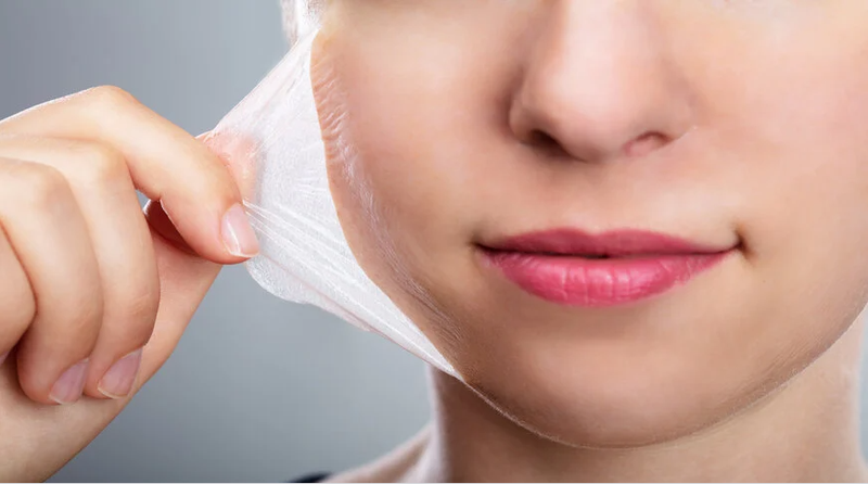 VI Peel hoạt động như thế nào?