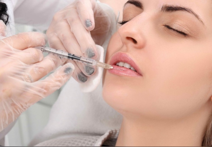 Tại sao nên tiêm Filler môi tại Thẩm mỹ viện HOA ANH ?