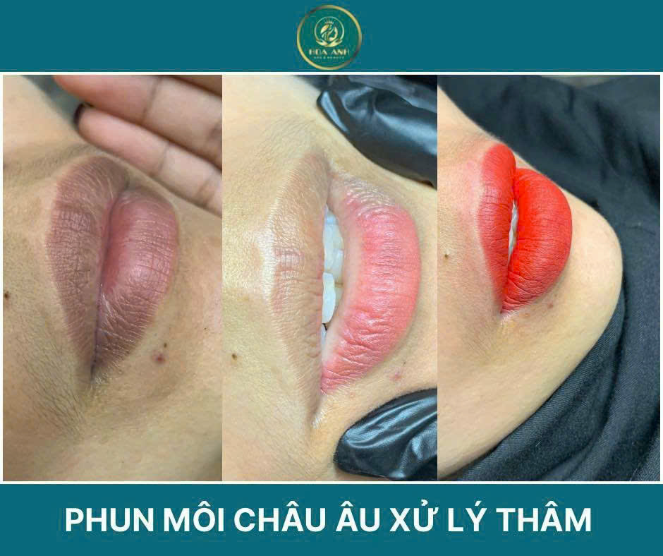 Tại sao phải khử thâm môi trước khi phun môi?