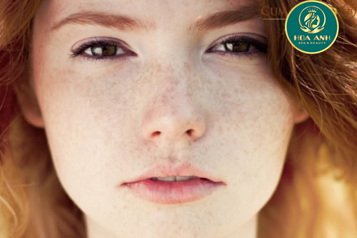 Cách loại bỏ các đốm, chấm đen trên da mặt