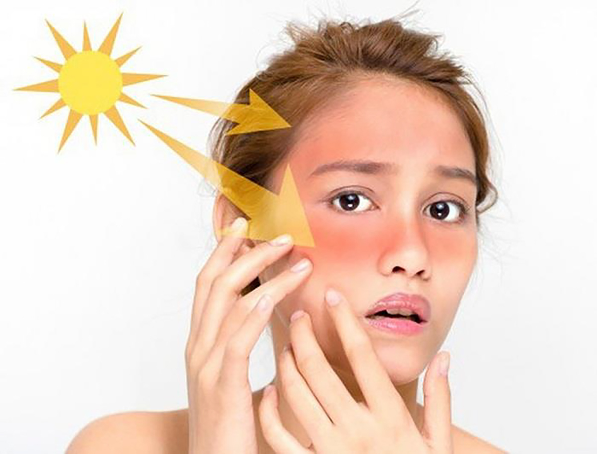 Chống Nắng Quan Trọng Như Thế Nào Với Làn Da?