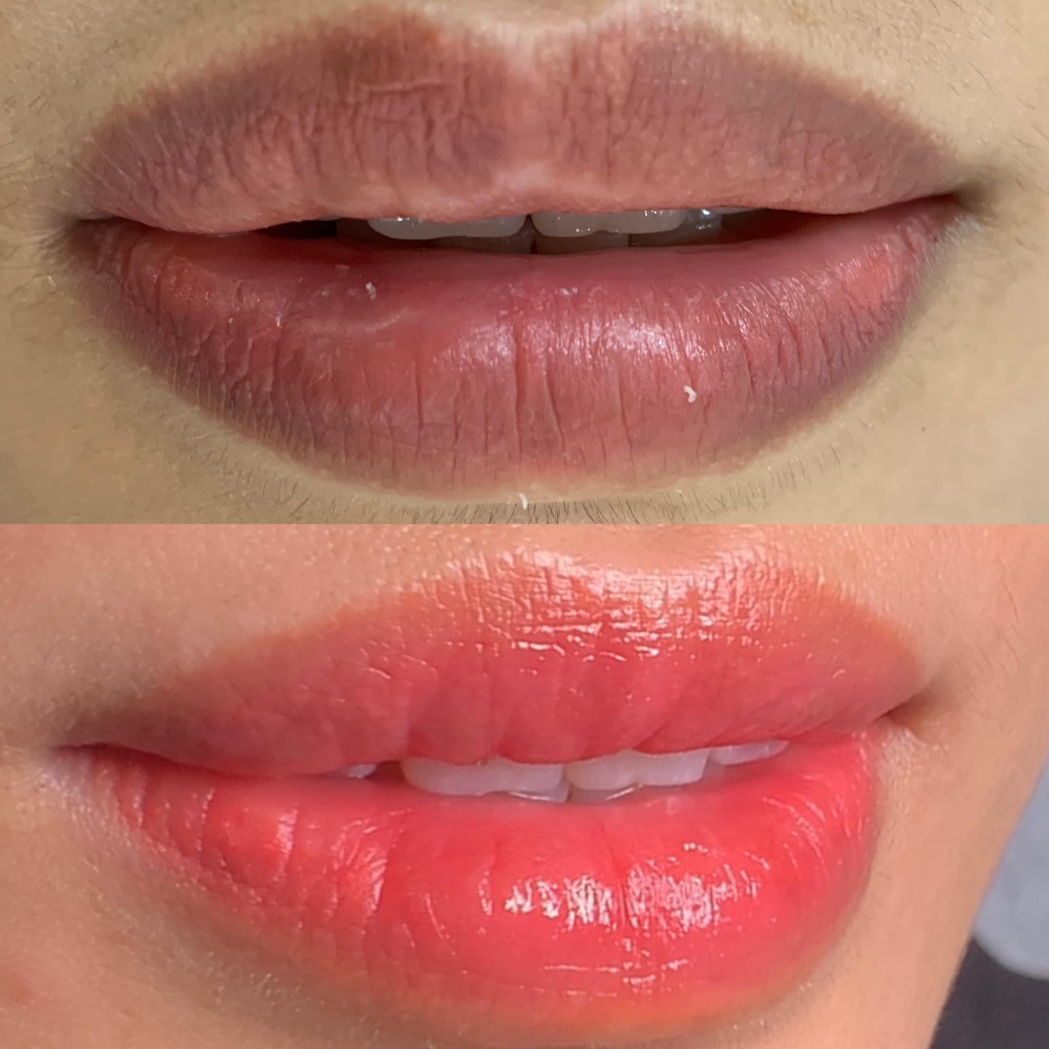 Bí Quyết Giữ Môi Hồng Tự Nhiên Sau Khi Phun – Hướng Dẫn Chi Tiết Từ Thẩm Mỹ Viện Hoa Anh