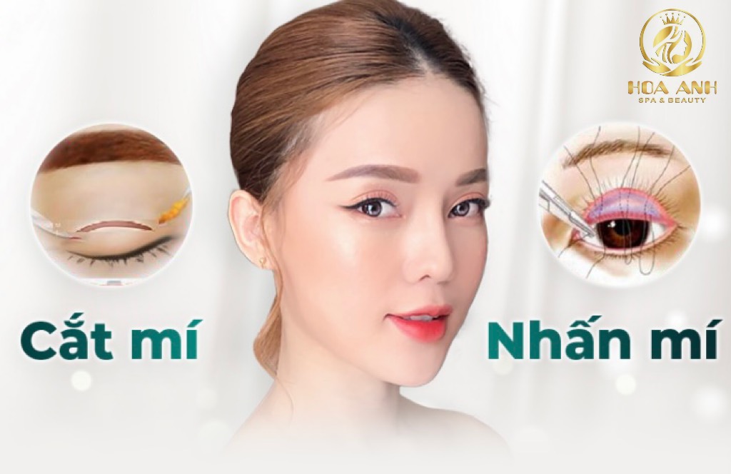 Nhấn mí giữ được bao lâu?