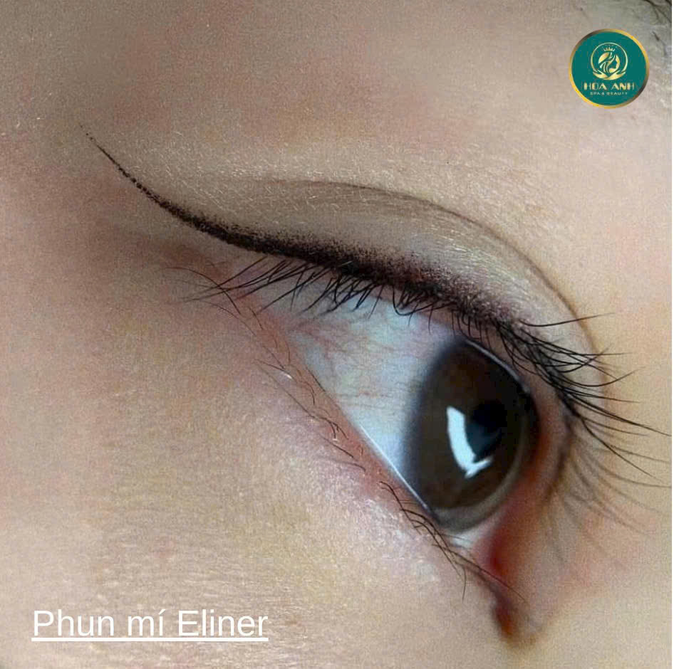 Phun Mí Mắt Có Ảnh Hưởng Tới Mắt Không? Bác Sĩ Hoa Anh Giải Đáp Sự Thật Khiến Nhiều Người Bất Ngờ