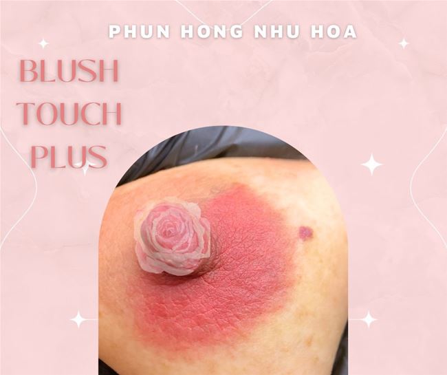 Nên tránh những gì khi phun hồng nhũ hoa ?
