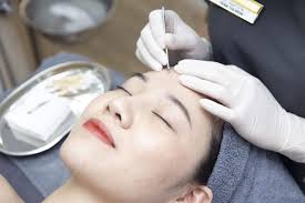 THẾ NÀO LÀ ĐIỀU TRỊ MỤN
