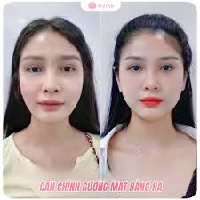CÂN CHỈNH FULLFACE