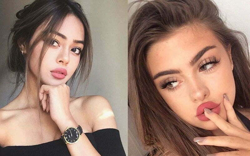 Tiêm môi tây là gì?