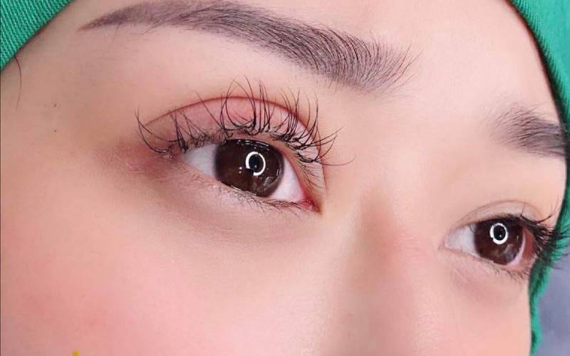 Sau nhấn mí kiêng ăn gì để mí nhanh lành, hạn chế sẹo xấu?