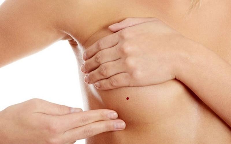 Nốt ruồi son là gì, nốt ruồi son ở đâu là may mắn?