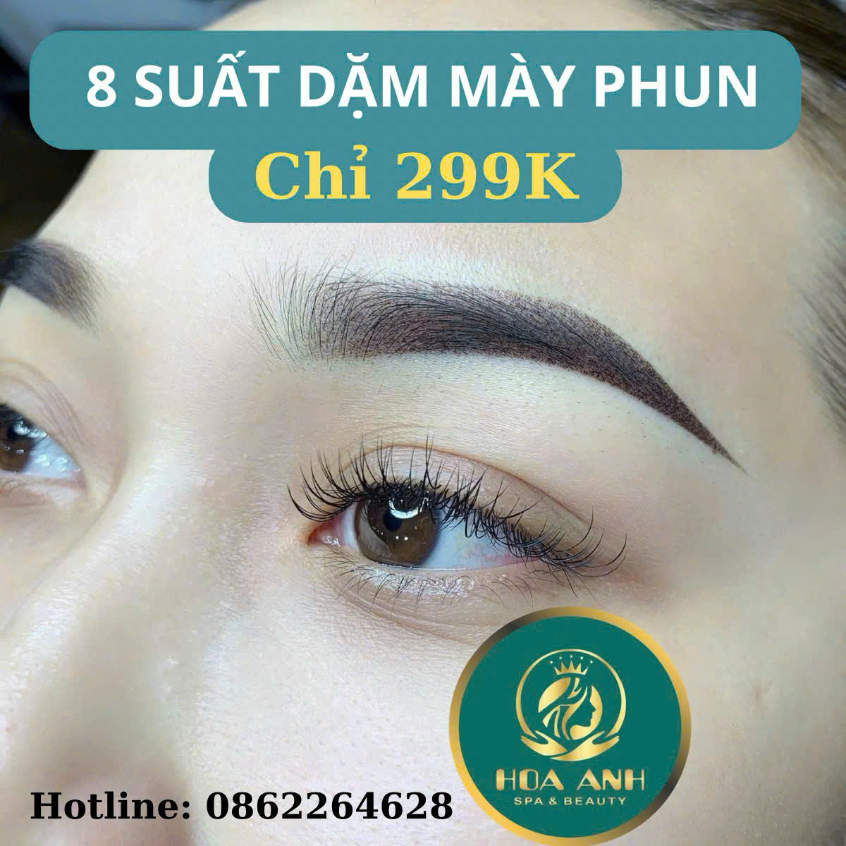 Chăm Sóc Mày Sau Khi Phun Tại Nhà – Hướng Dẫn Chi Tiết Từ Thẩm Mỹ Viện Hoa Anh