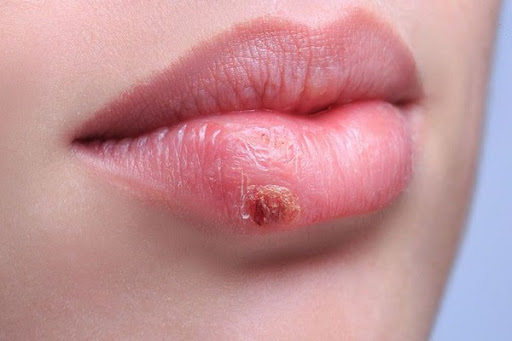 Dấu hiệu phun môi bị hỏng – Nguyên nhân và Cách khắc phục