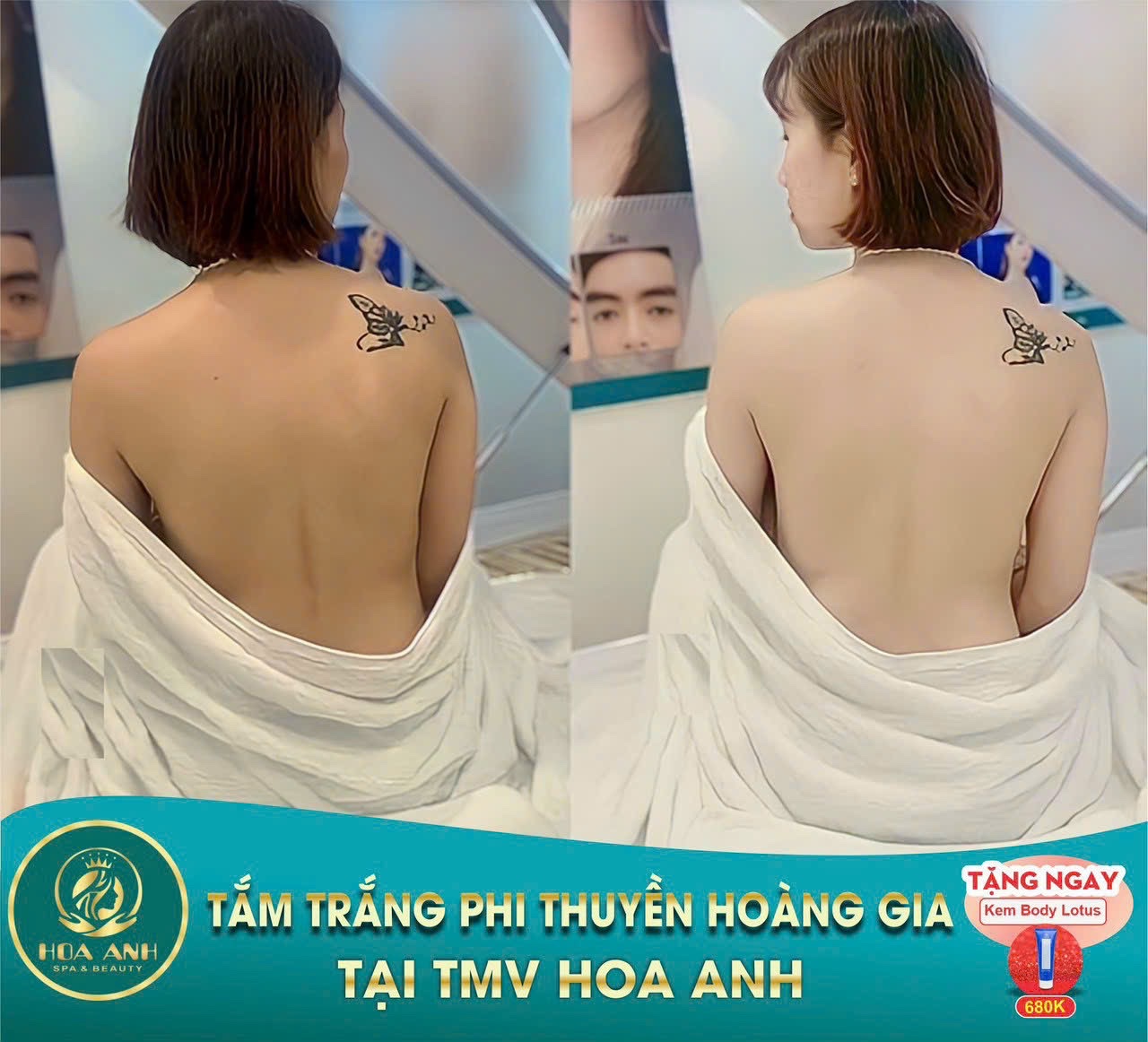 Tắm trắng phi thuyền có thật sự trắng như lời đồn?