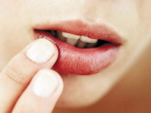 Phun môi không đều màu: Nguyên nhân và cách khắc phục