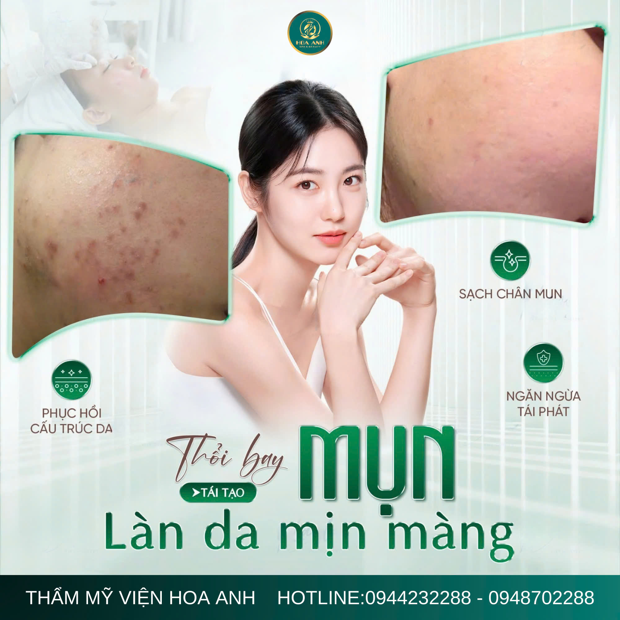 NỖI SỢ KHI BỊ MỤN Ở TUỔI DẬY THÌ VÀ CÁCH CHỮA TRỊ ĐÚNG CÁCH