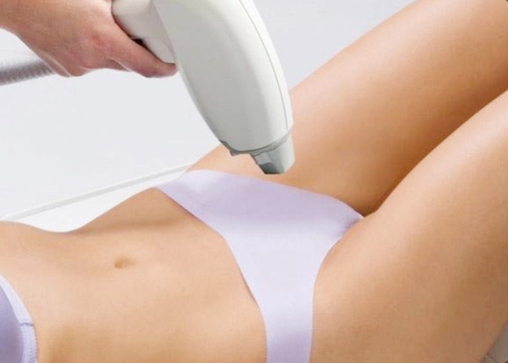 CÓ NÊN TRIỆT LÔNG BIKINI?