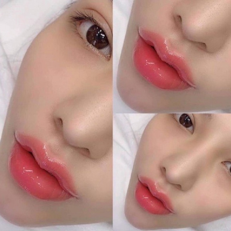 Natural beautiful lip filler