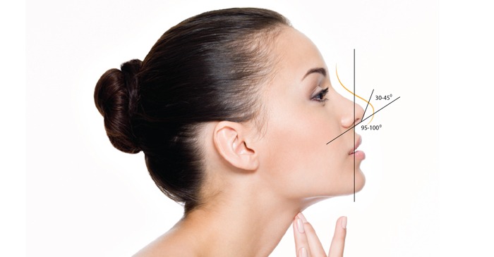 nâng mũi bằng chỉ collagen cho kết quả tương đối tốt nếu được thực hiện đúng quy trình và chất lượng chỉ collage