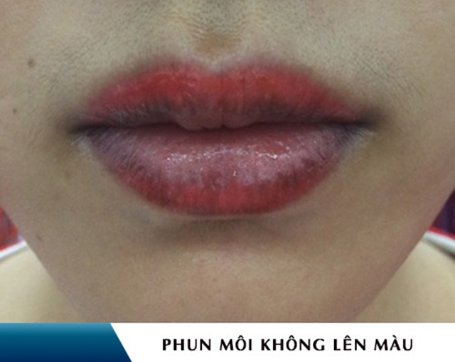 Phun môi không đều màu: Nguyên nhân và cách khắc phục tại kiêng giang